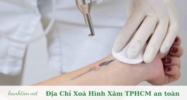 địa chỉ xoá hình xăm